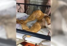 獨居老婦倒臥家中飄糞味 護理師無怨言替她沖澡換裝