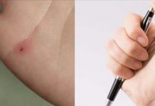 他發文求助「鉛筆芯插手裡怎麼辦?」怎料引來熱議爭著狂曬手上黑點