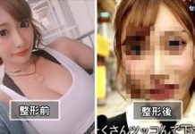 明日花整壞了? 近照零美圖「過度人工化」網民截圖:回不去了QQ遠目