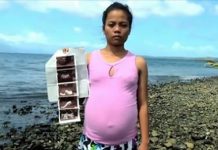 「深海異形讓她懷孕」女子照超音波驚現腹中魚臉…一年後真相曝光