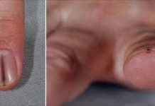 客人要求用指彩蓋掉「奇怪黑線」美甲師急勸立即就醫 可惜「一切都太遲了」