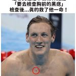 這名奧運冠軍被粉絲提醒「要去檢查胸前的黑痣」檢查後…真的救了他一命!