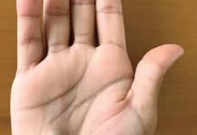 他看完牙醫後手上長出一顆藍色小球,又在短時間內掉了12公斤,嚇得他趕快去醫院求助!