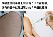 快檢查你的手臂上有沒有「這個特殊印記」沒有的話你就是超稀少的「幸運兒體質」!