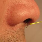 「鼻毛跑出來」該拔掉還是剪掉?醫生叮嚀:千萬別再做傻事了!