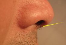 「鼻毛跑出來」該拔掉還是剪掉?醫生叮嚀:千萬別再做傻事了!