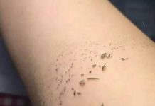 洗澡時搓出來的泥到底是什麼?多數人都搞錯,難怪皮膚還那麼差