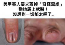 美甲客人要求蓋掉「奇怪黑線」勸她馬上就醫沒想到「一切都太遲了」…
