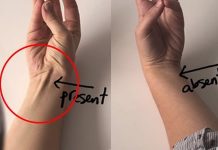 你或你身邊的人手腕有「這條筋」嗎?原來它竟是上天賜的禮物