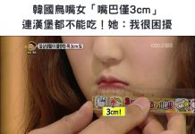 韓國鳥嘴女「嘴巴僅3cm」連漢堡都不能吃!她:很困擾