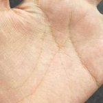 手掌有特殊「M字型」掌紋的人,少有的福星,有這種手相的真不多,個個是有錢人~