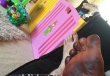 男子一覺醒來「腳發黑」緊急叫救護車,才發現兇手是老婆…