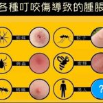 各種叮咬傷導致的腫脹 男人會造成……..?
