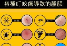 各種叮咬傷導致的腫脹 男人會造成……..?
